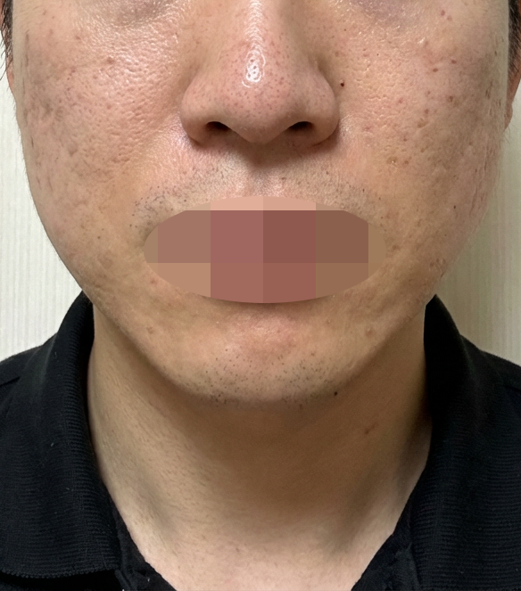 수술후기이미지