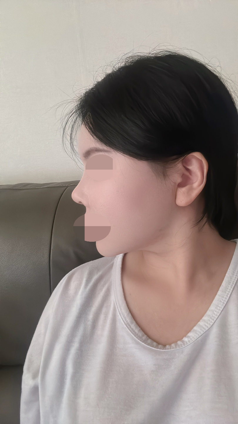 수술후기이미지