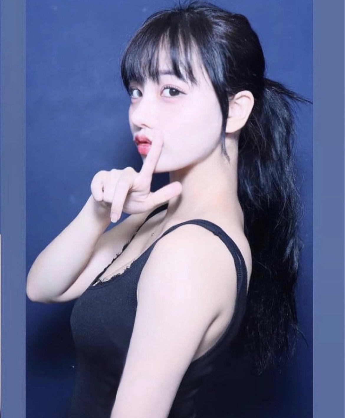 수술후기이미지