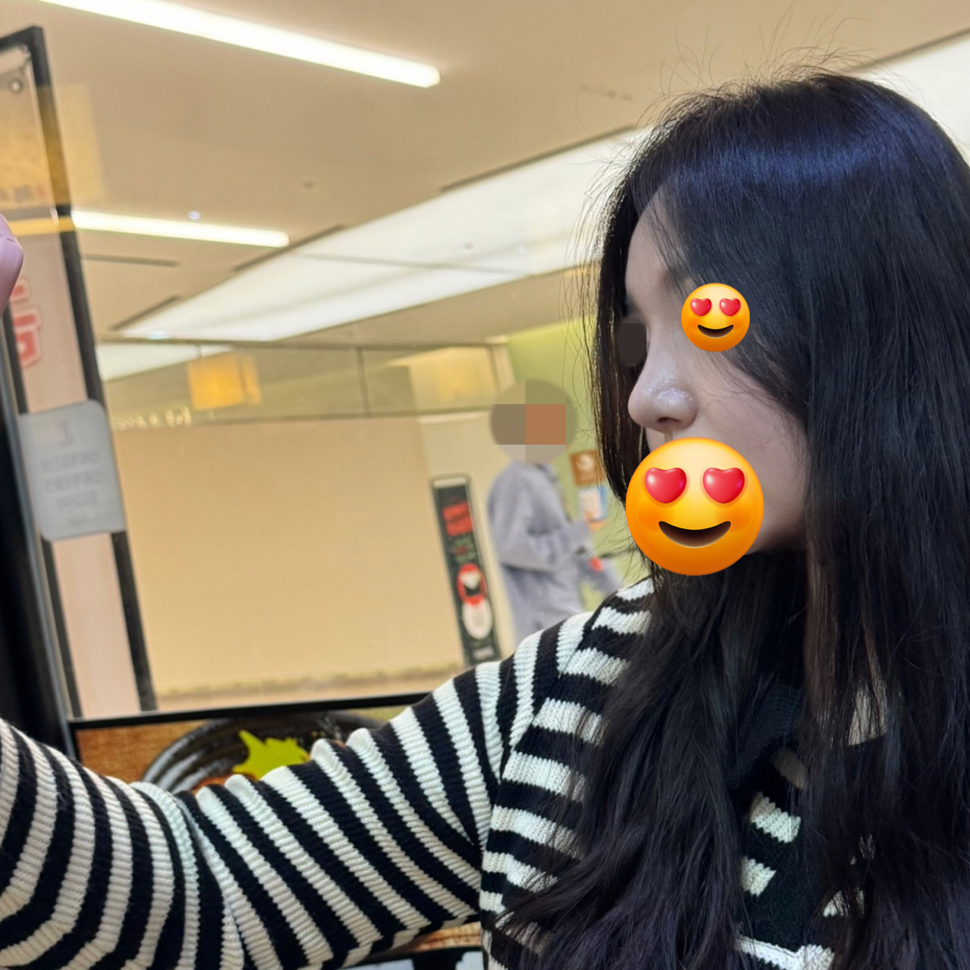 수술후기이미지