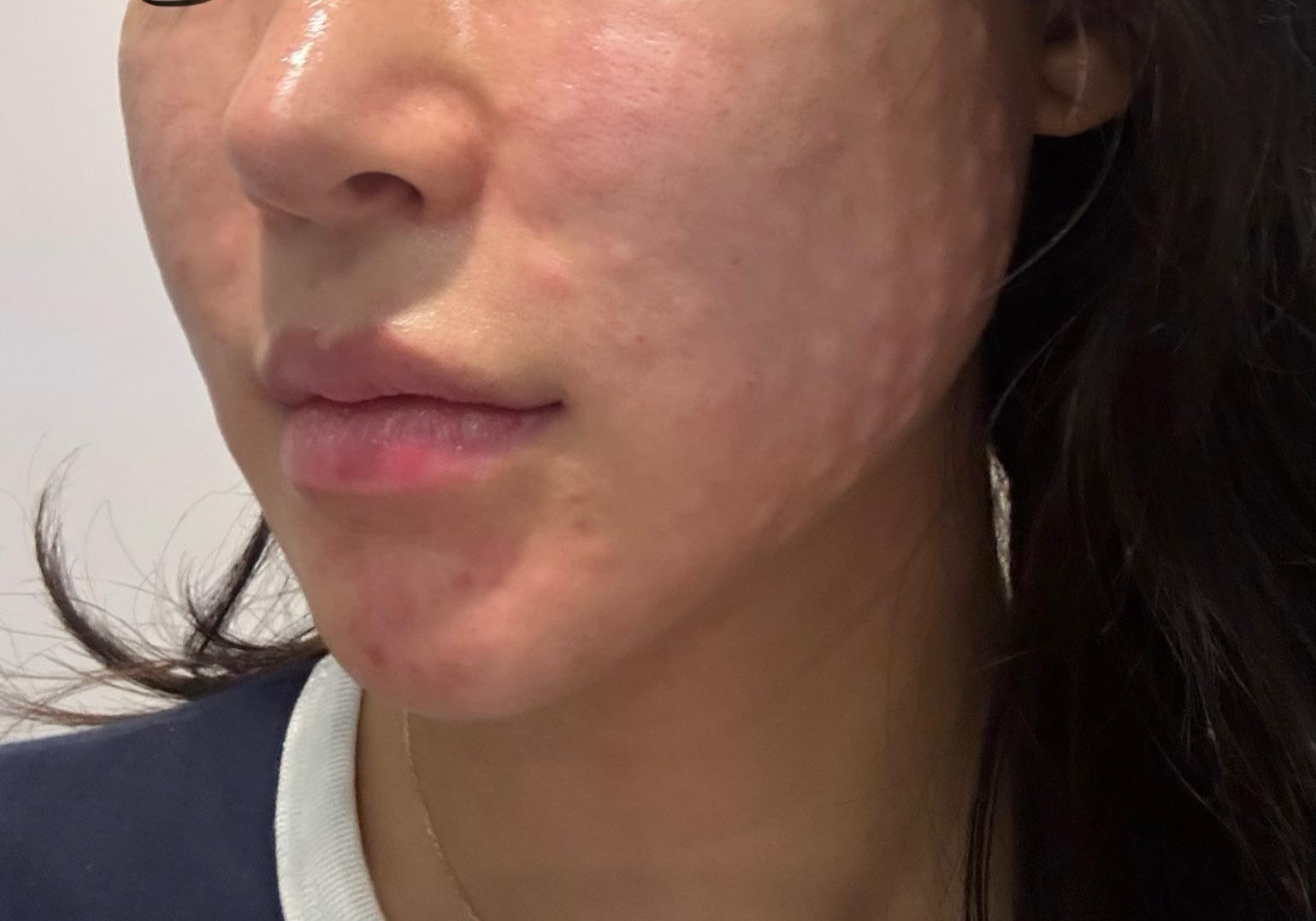 수술후기이미지