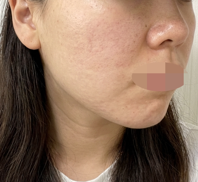 수술후기이미지