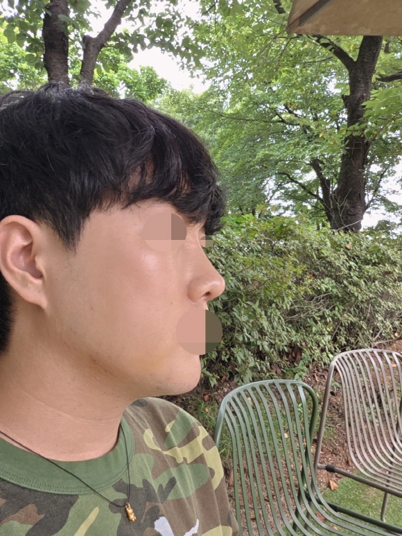 수술후기이미지