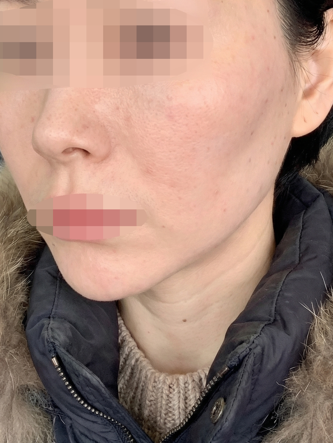 수술후기이미지