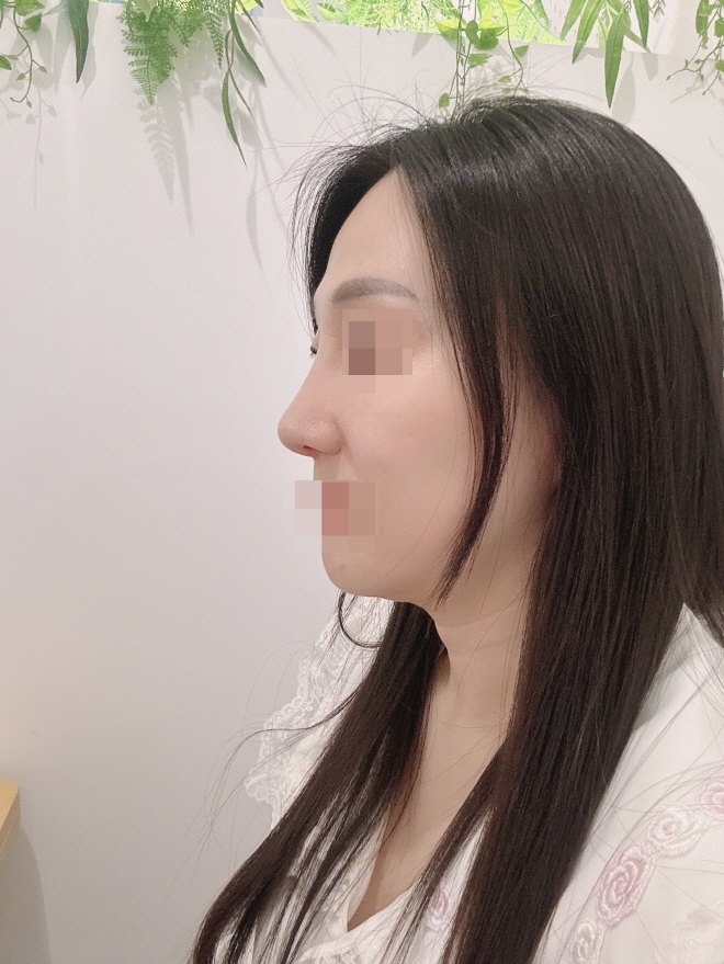 수술후기이미지