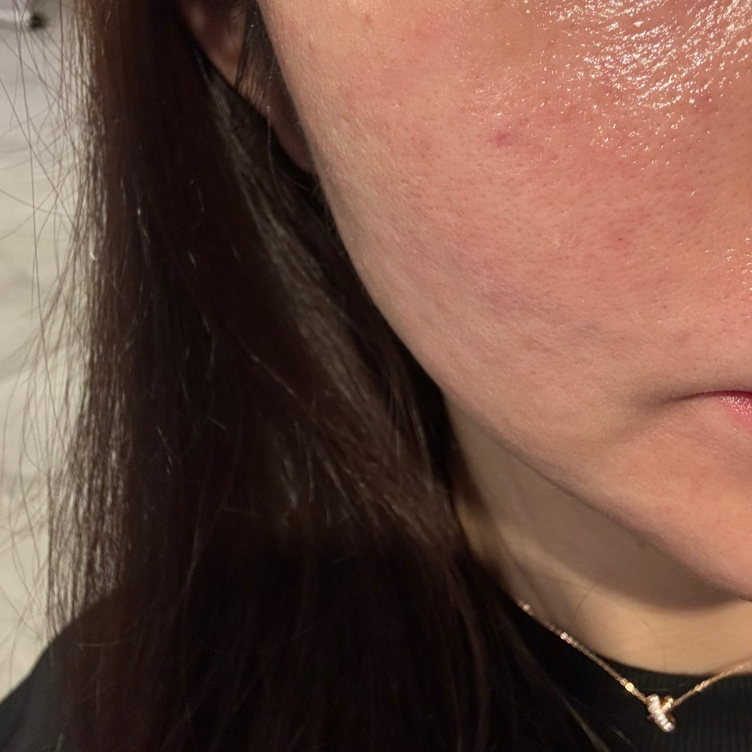 수술후기이미지