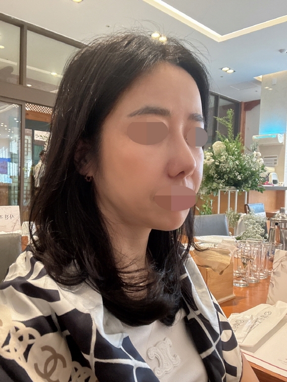 수술후기이미지