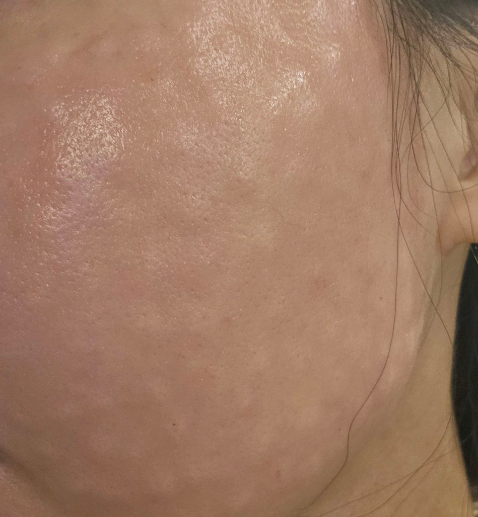 수술후기이미지