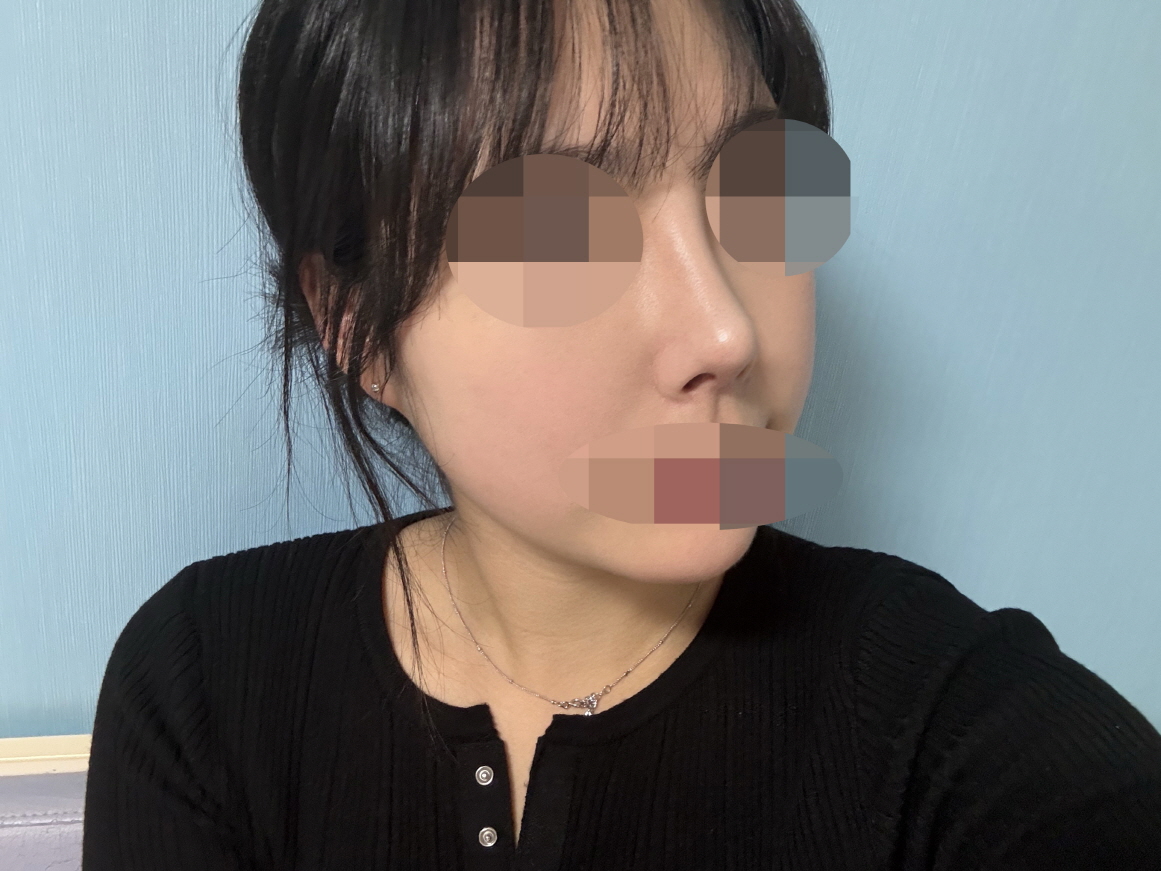 수술후기이미지