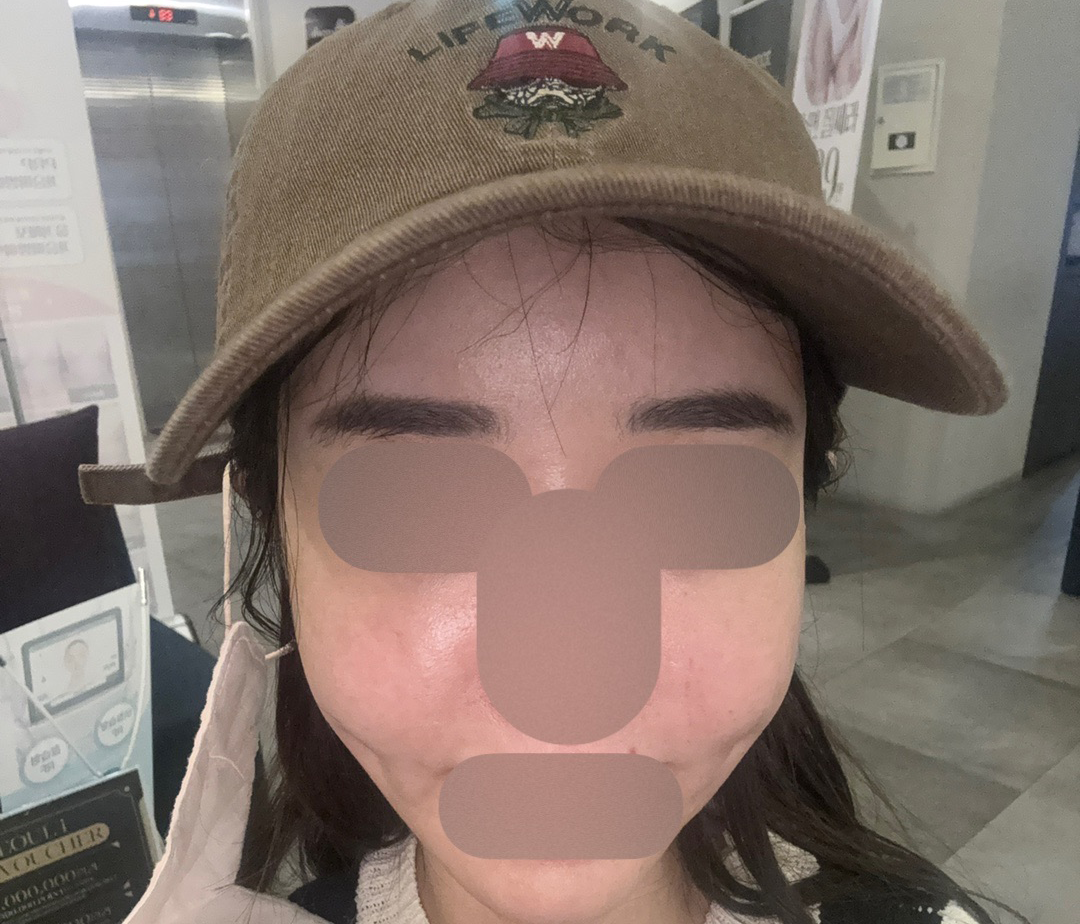 수술후기이미지