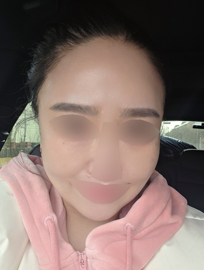 수술후기이미지