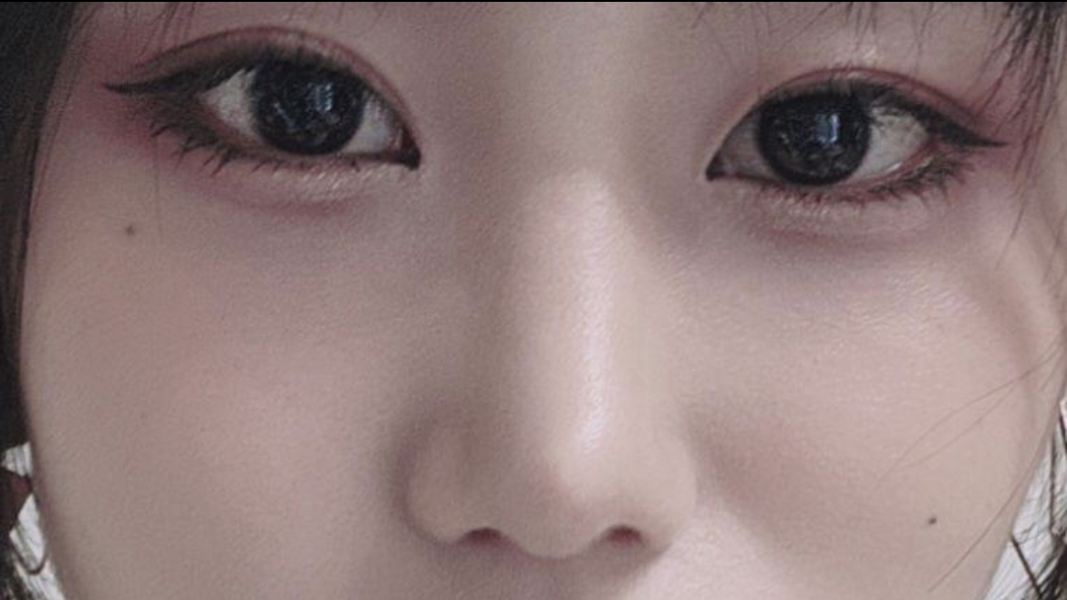 수술후기이미지