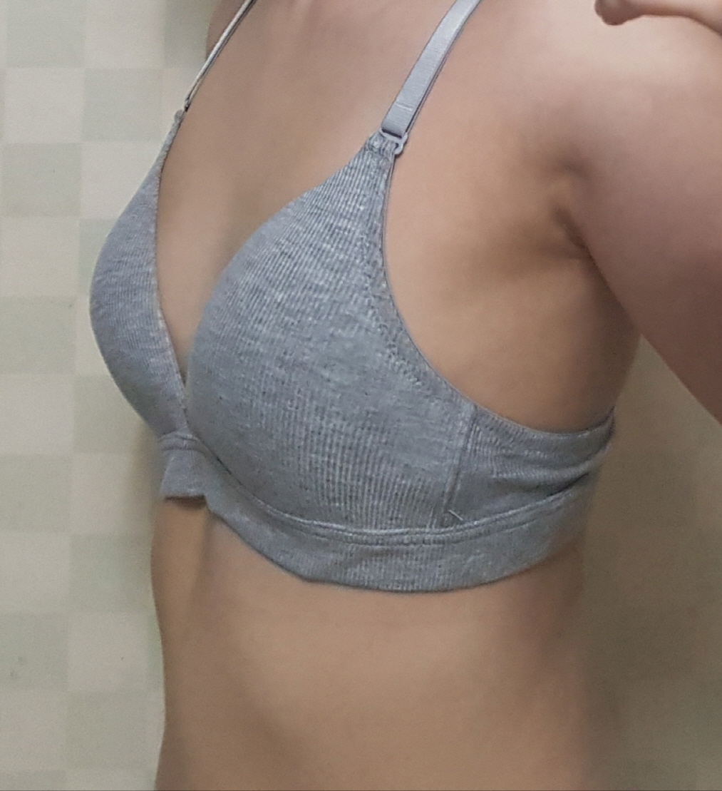 수술후기이미지