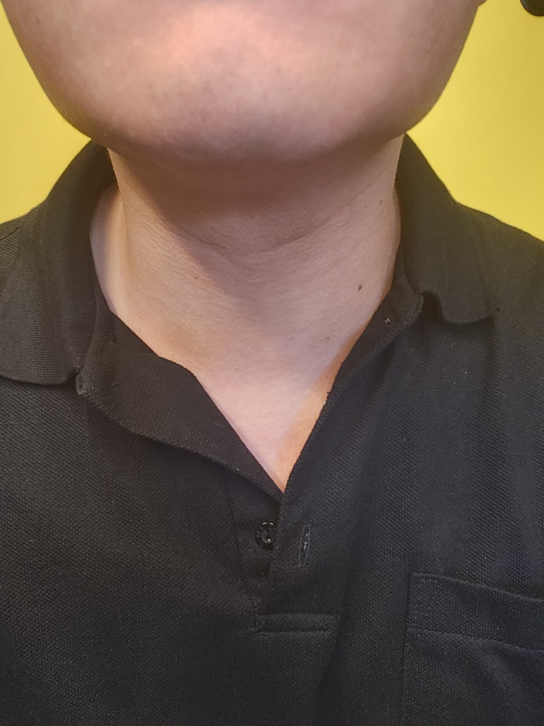 수술후기이미지