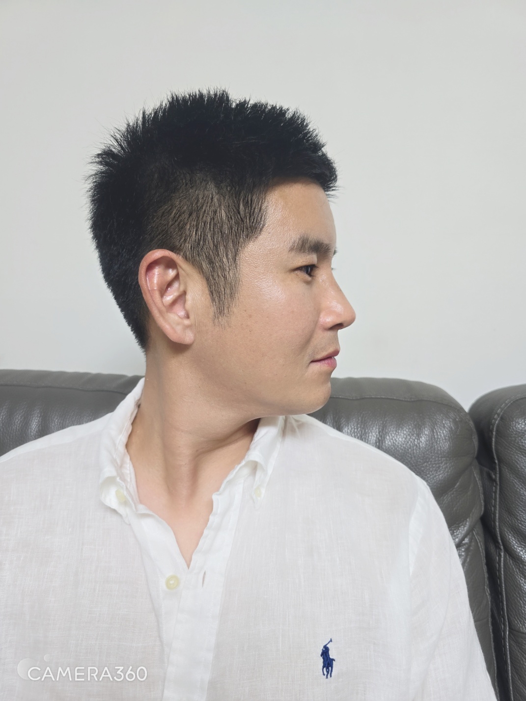 수술후기이미지