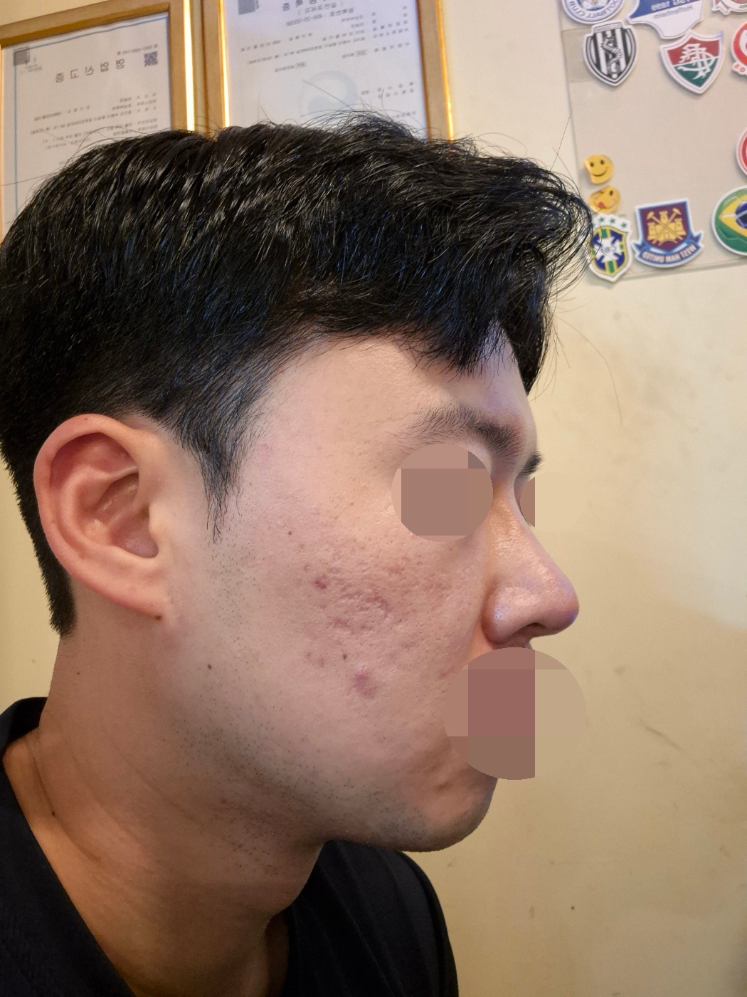 수술후기이미지