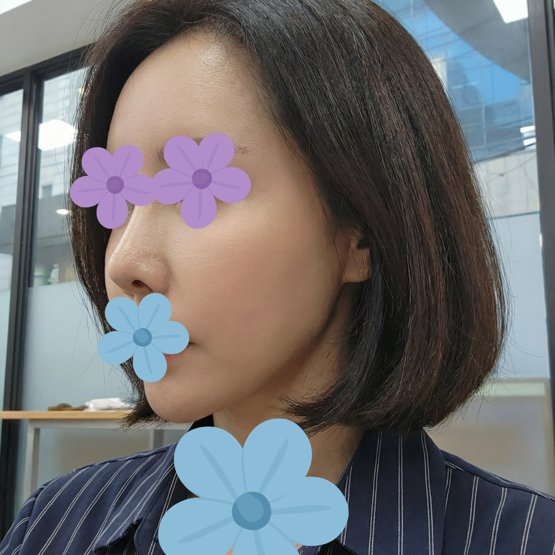 수술후기이미지