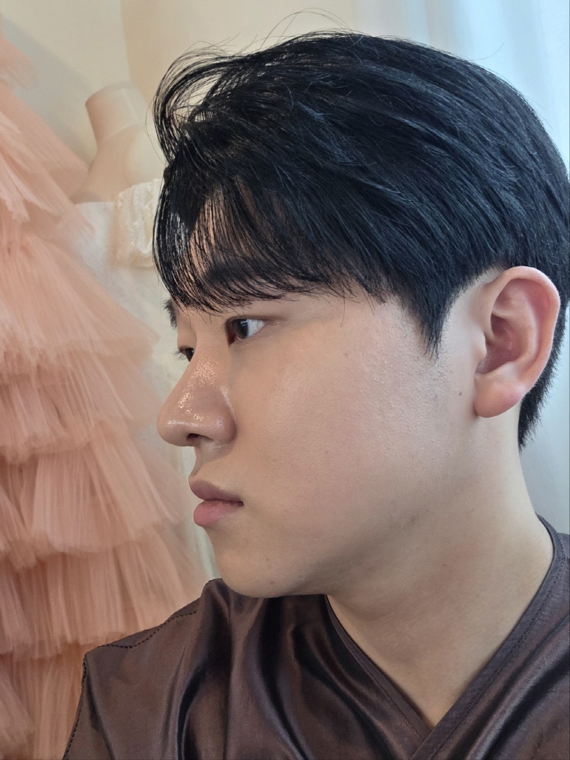 수술후기이미지