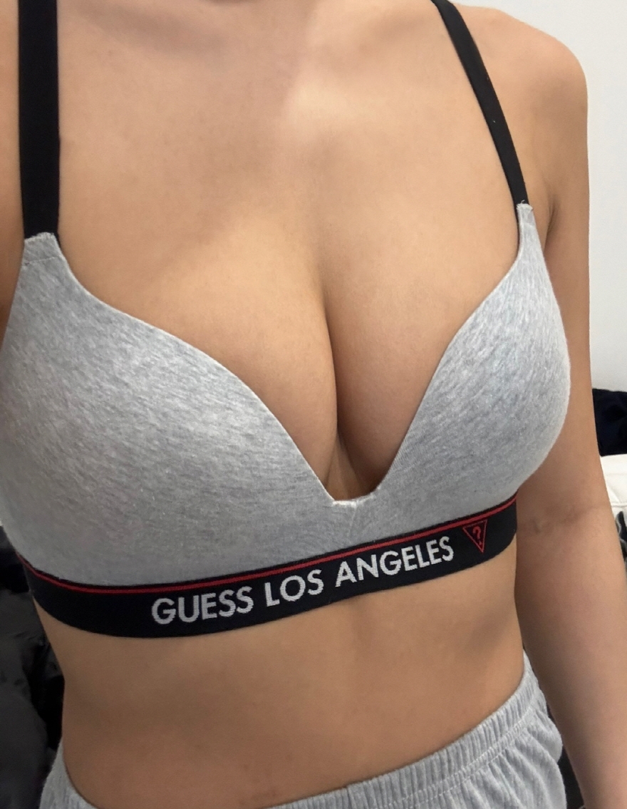 수술후기이미지