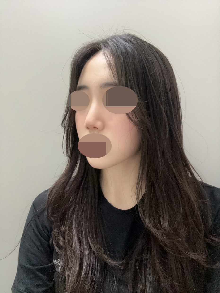 수술후기이미지