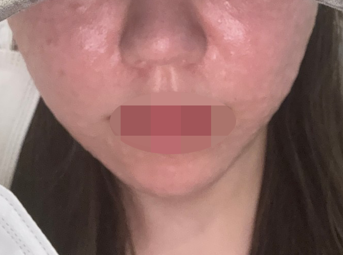 수술후기이미지