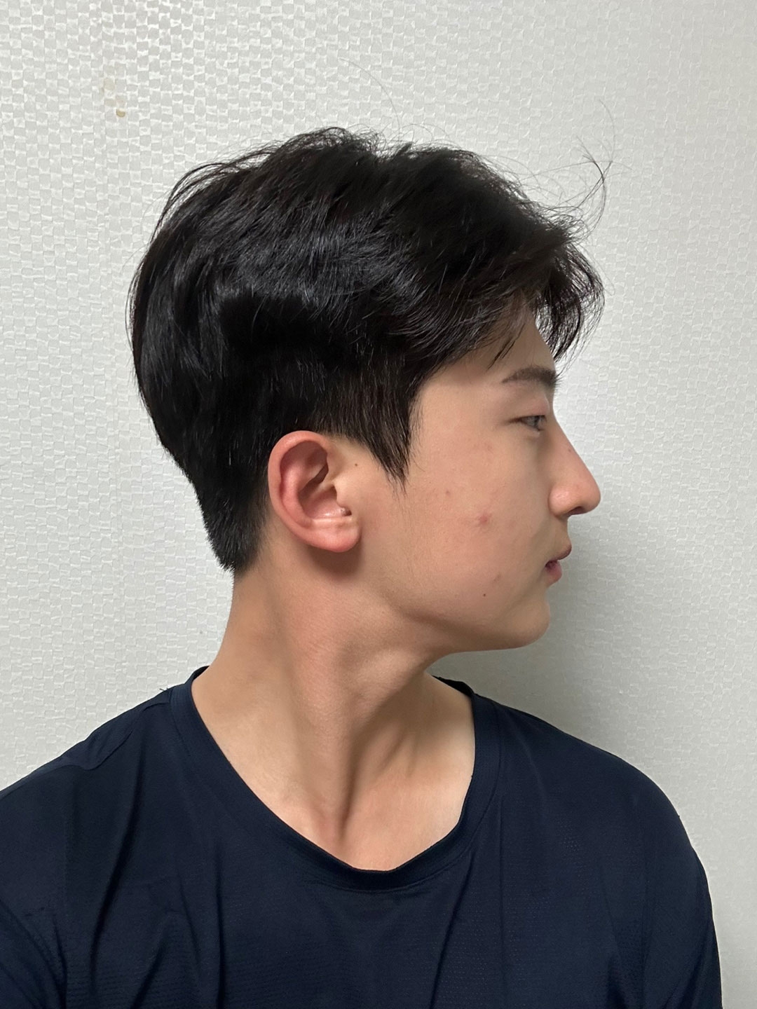 수술후기이미지