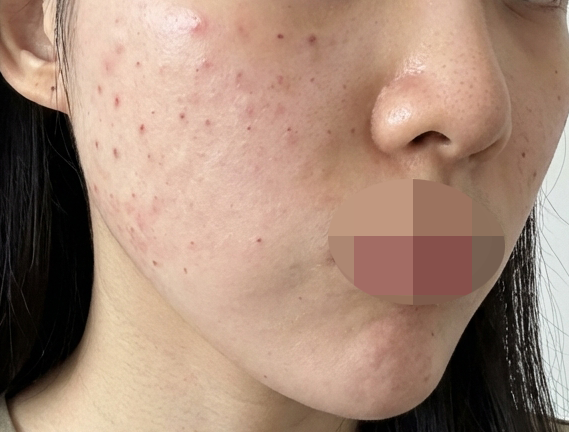 수술후기이미지