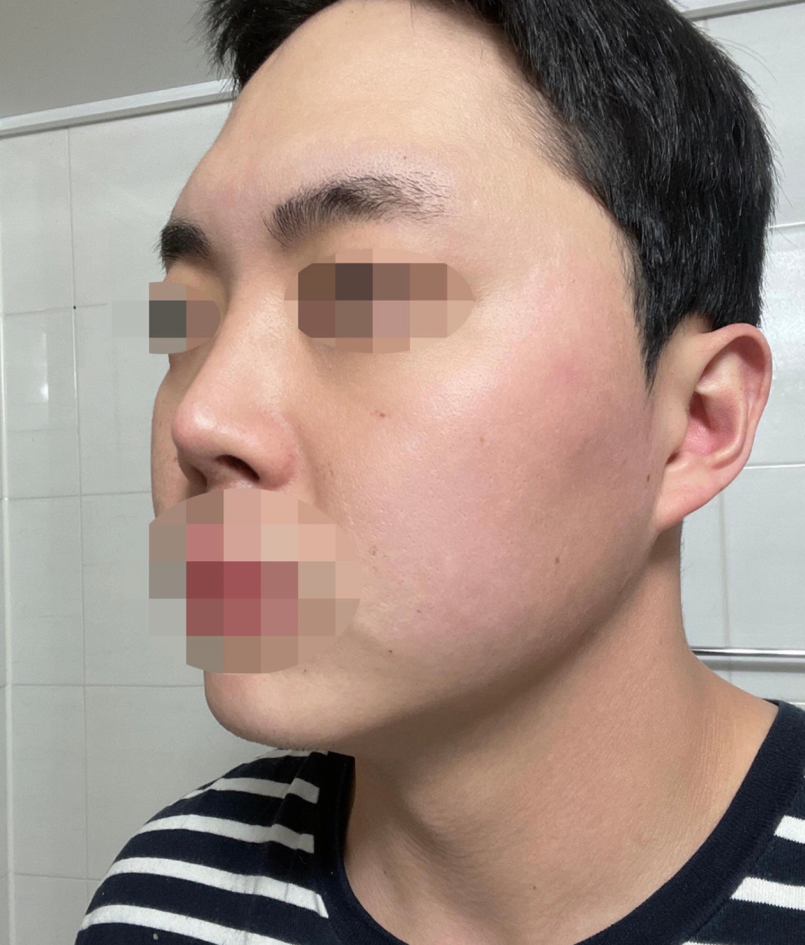 수술후기이미지