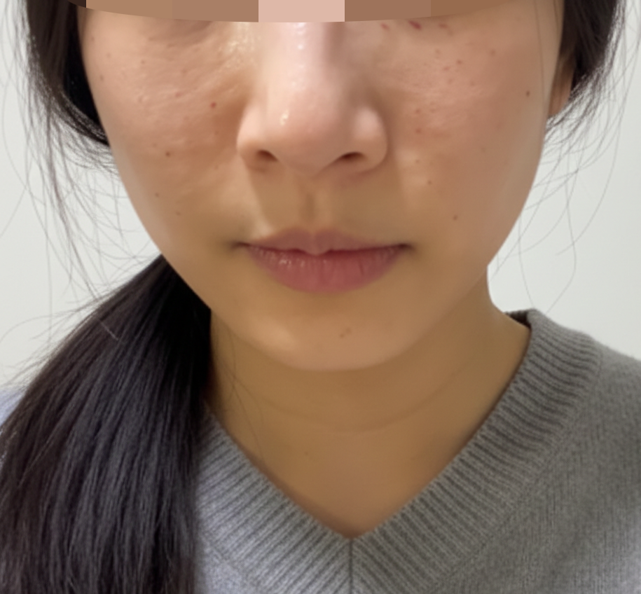 수술후기이미지