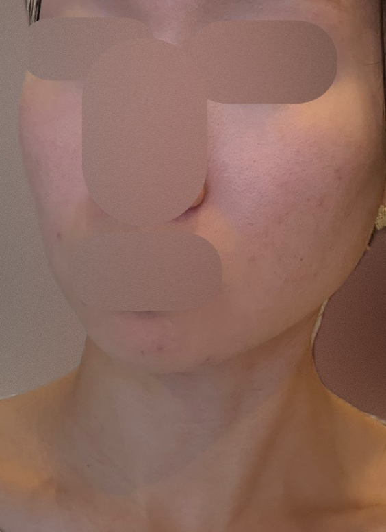 수술후기이미지