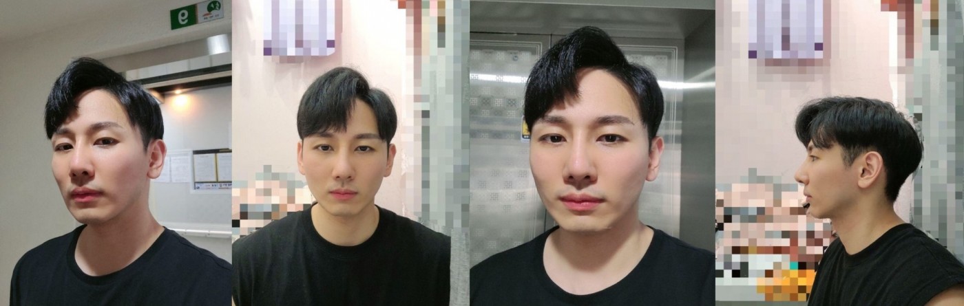 수술후기이미지