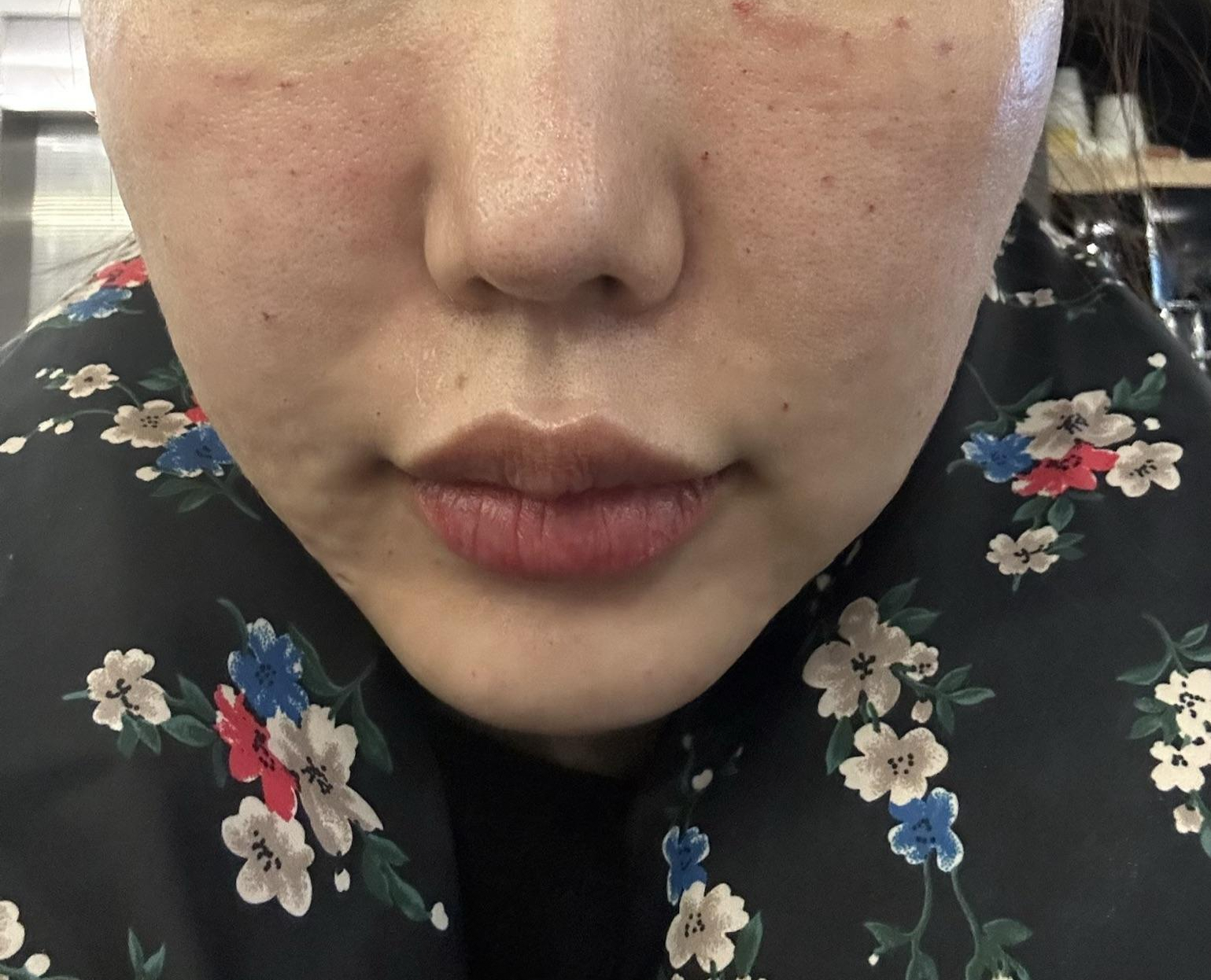 수술후기이미지