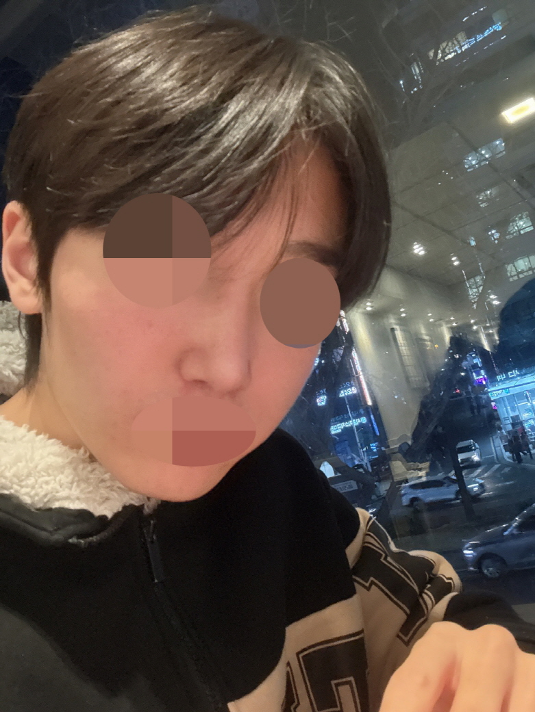 수술후기이미지