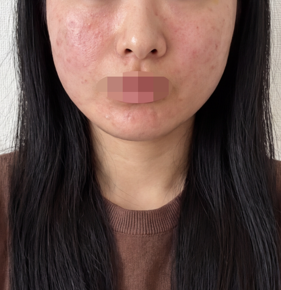 수술후기이미지