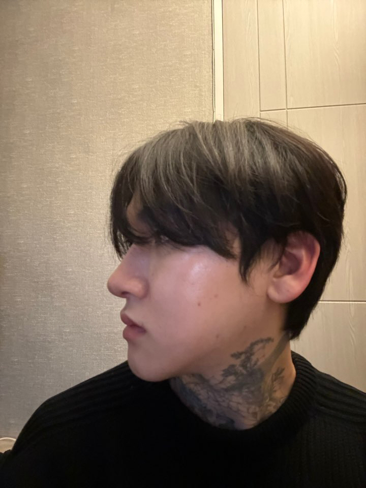 수술후기이미지