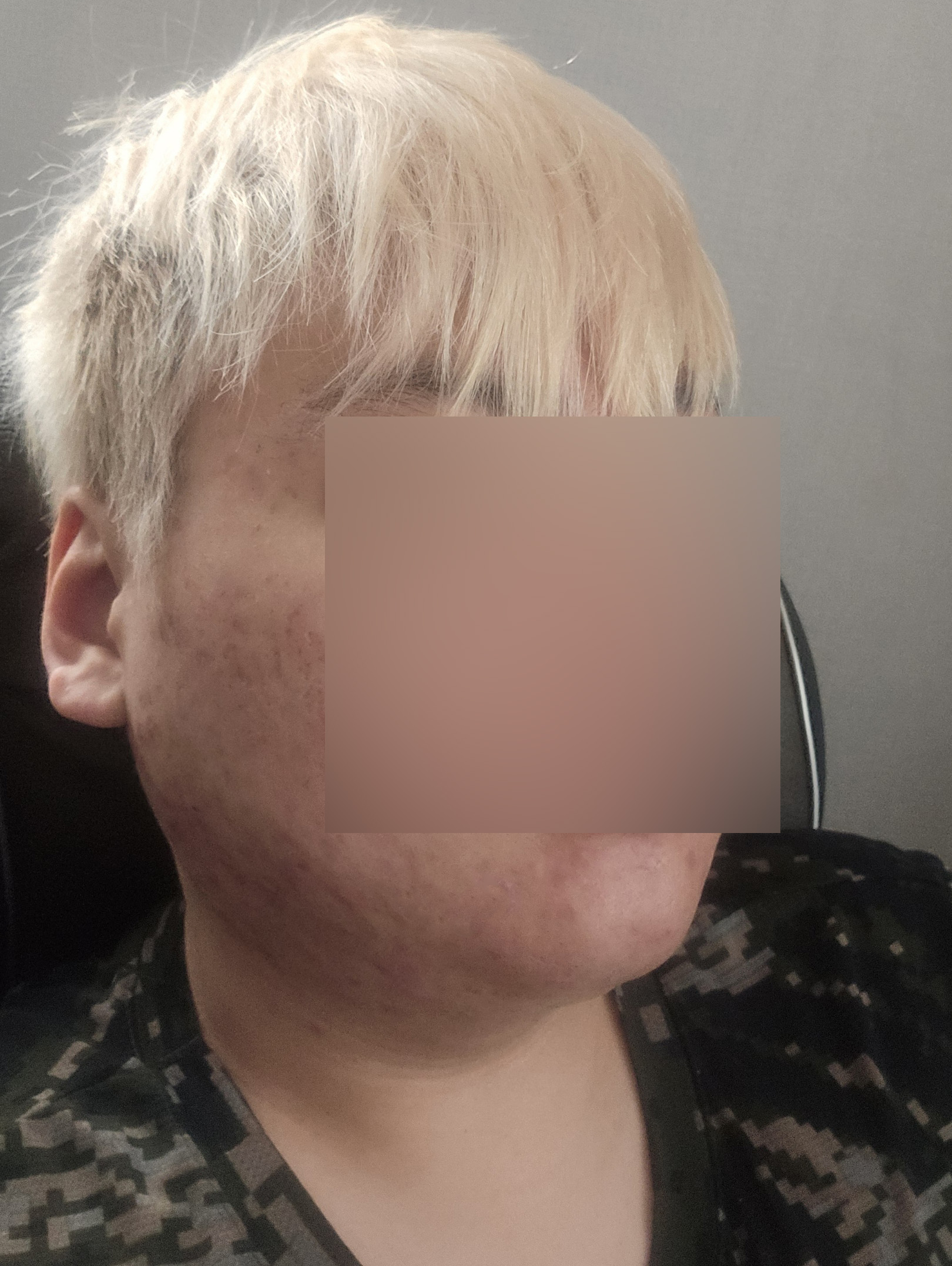 수술후기이미지