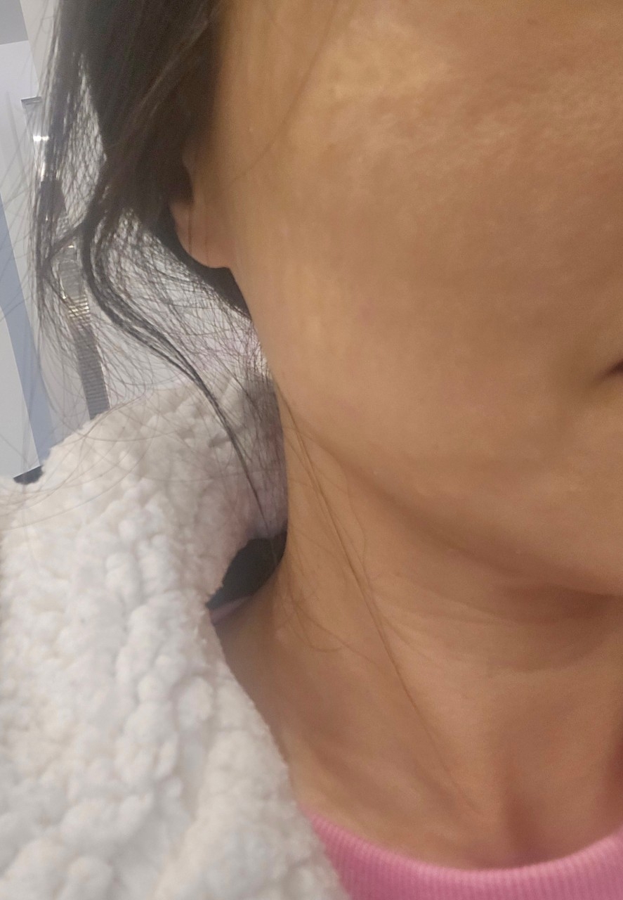 수술후기이미지