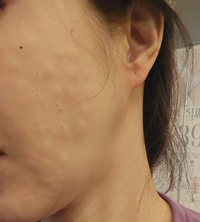 수술후기이미지