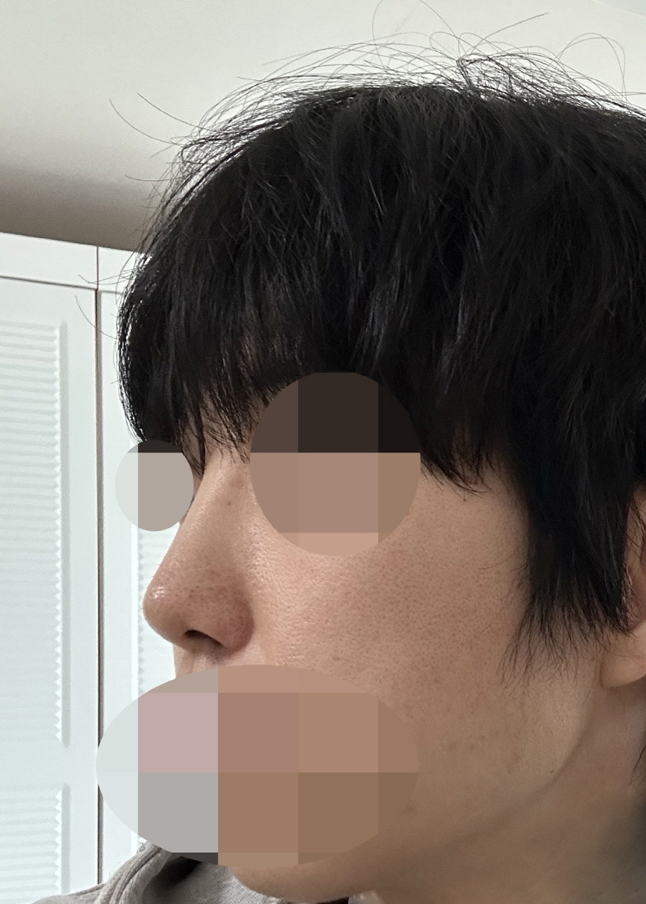 수술후기이미지