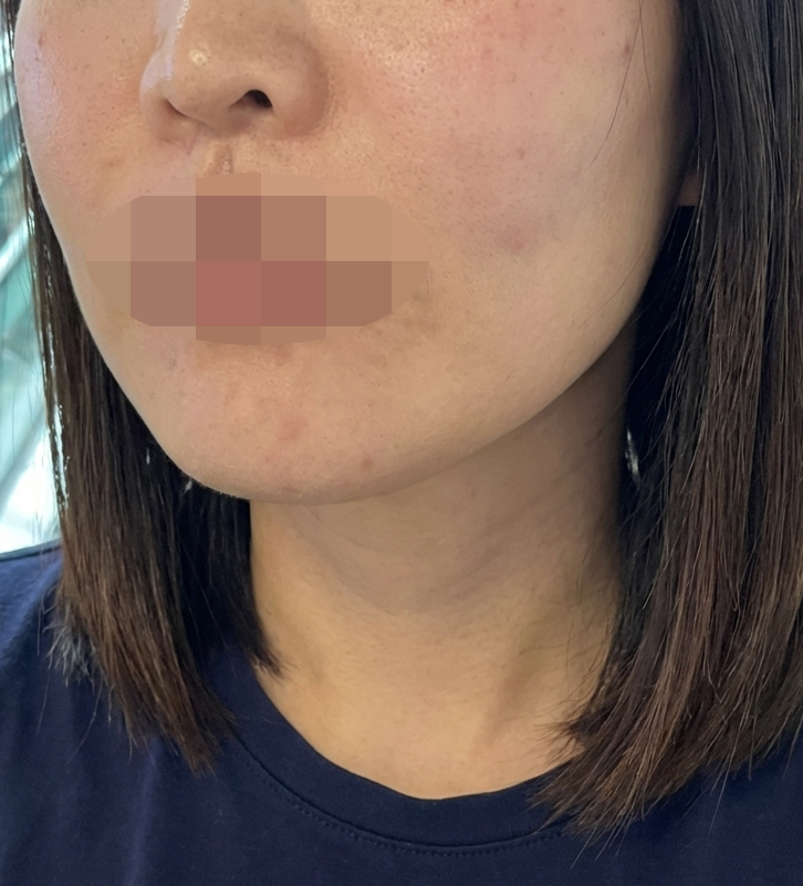 수술후기이미지