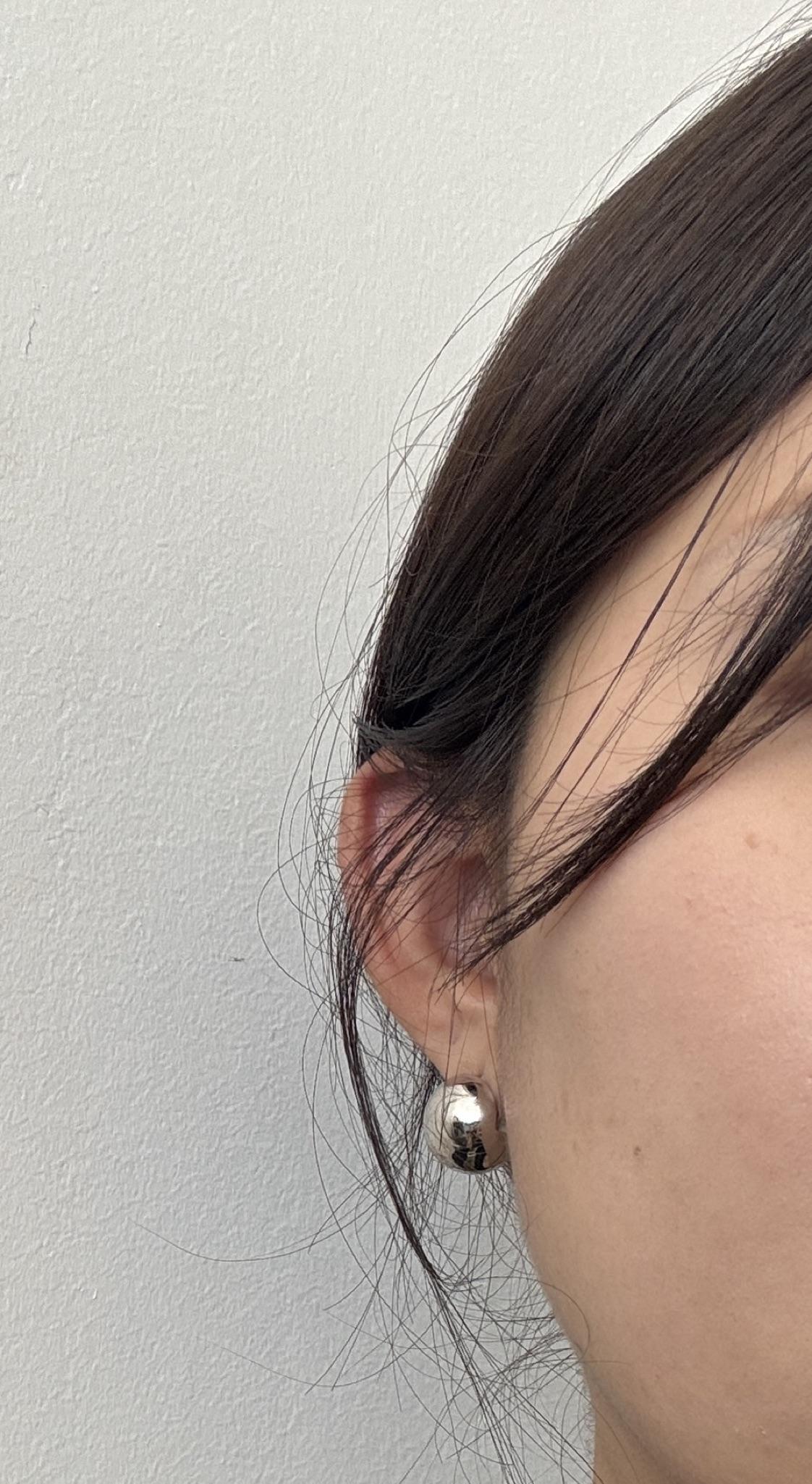 수술후기이미지