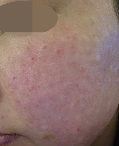 수술후기이미지