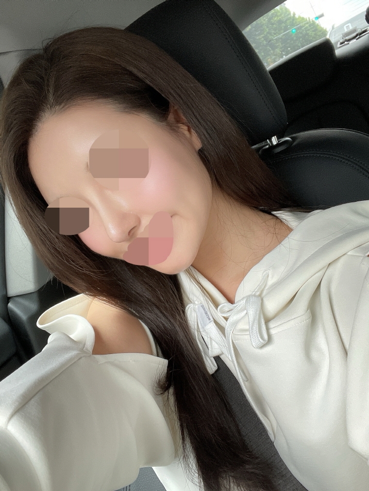 수술후기이미지