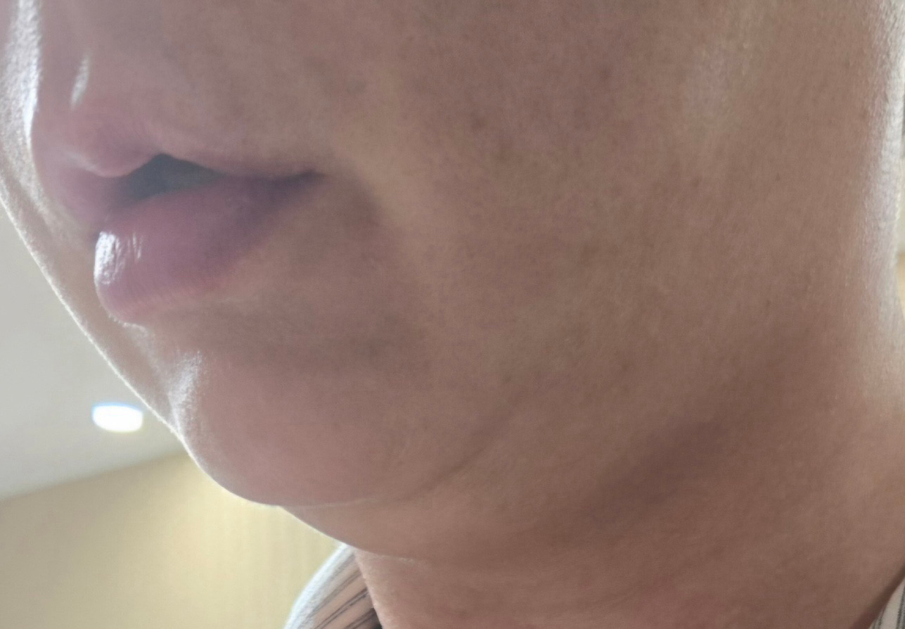 수술후기이미지