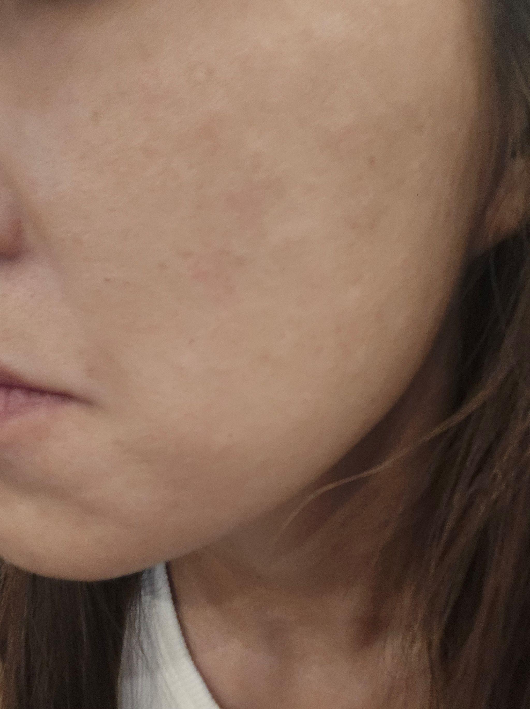 수술후기이미지