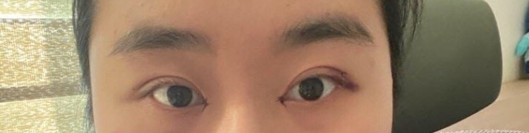 수술후기이미지