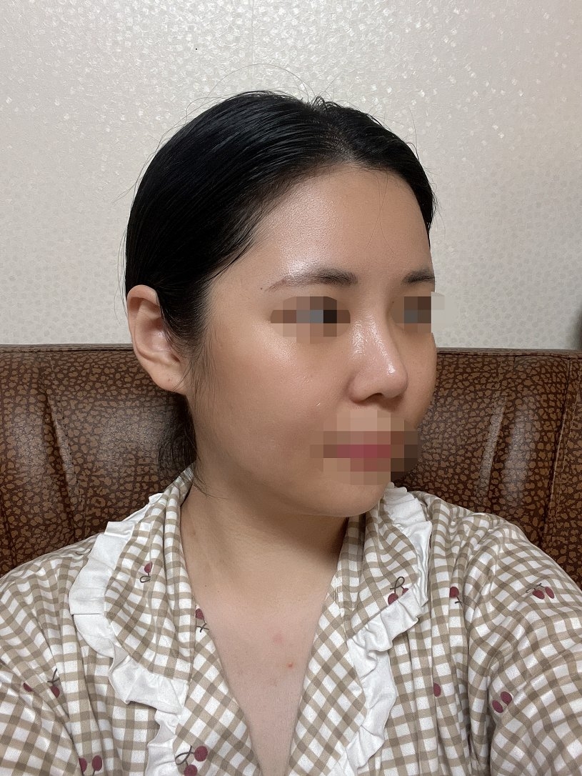 수술후기이미지