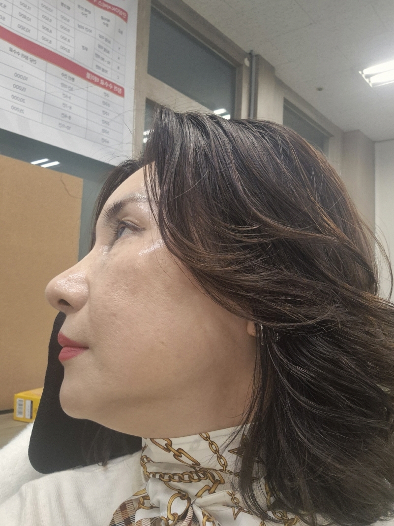 수술후기이미지