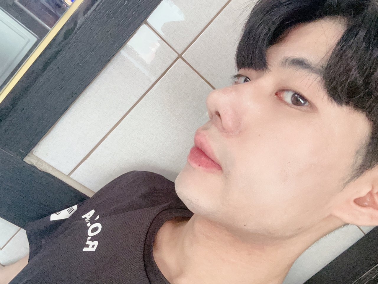 수술후기이미지