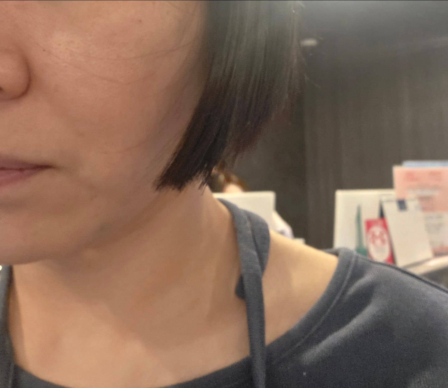 수술후기이미지